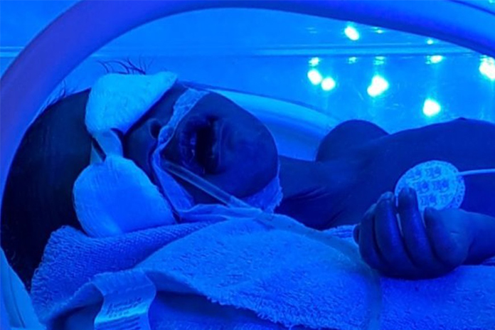 Baby Kairo in incubator
